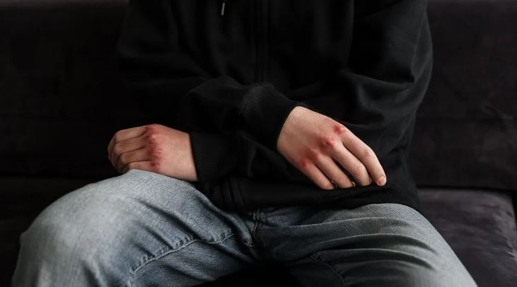 اشتباك بين قاصرين في وسط كالاماتا - هاجم المراهقون شابًا يبلغ من العمر ١٥ عامًا